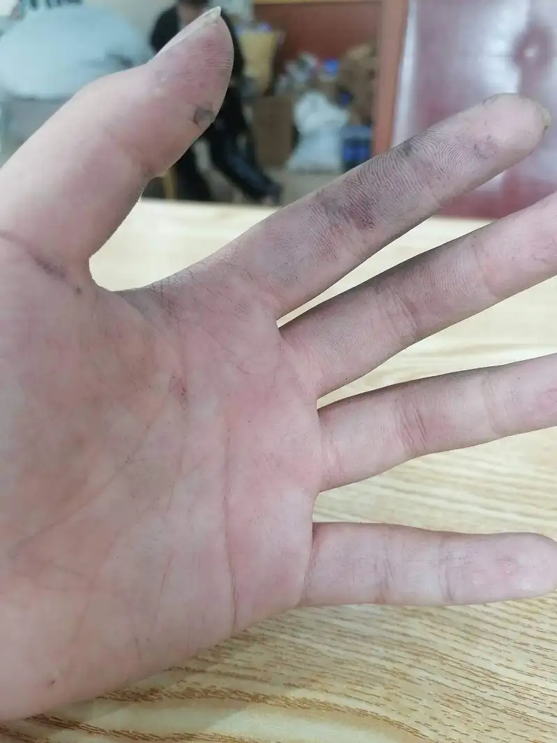 这是小学生的手？