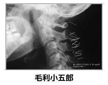 涩图