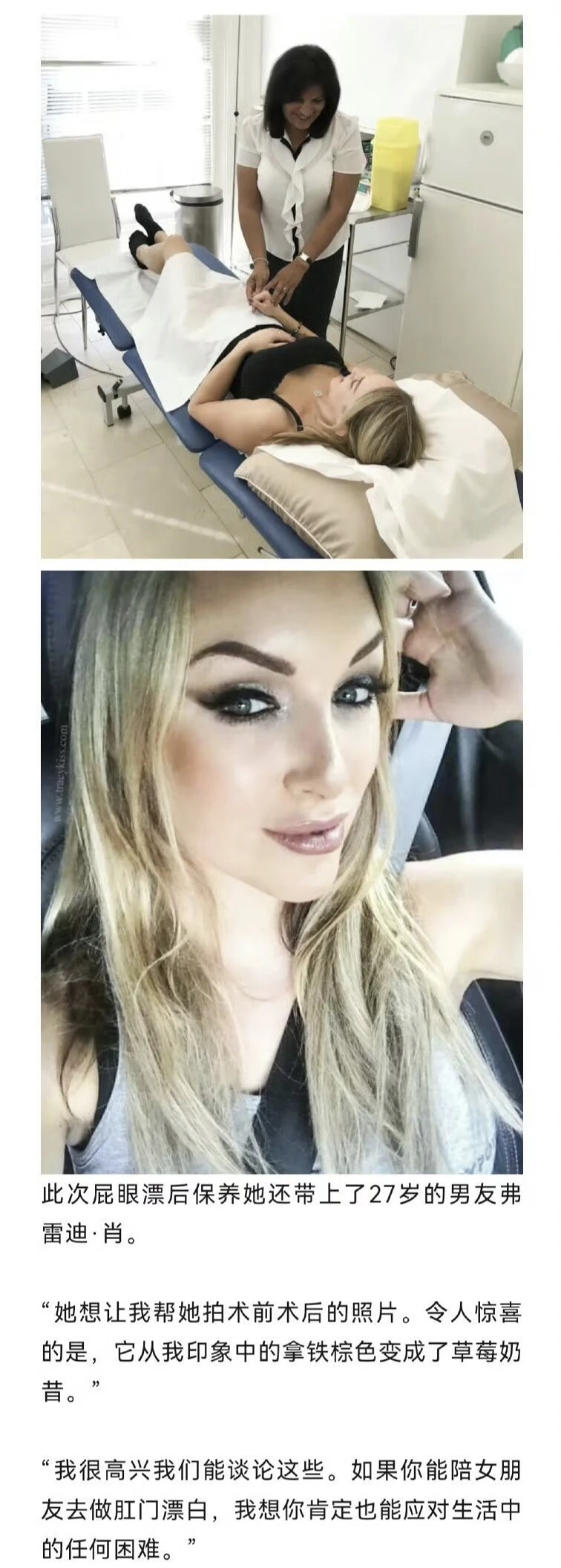 美白,皮燕,欧美,上流社会,时髦,美容,漂白,草莓奶昔,激光,ass