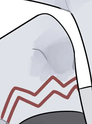给大家看看我画的膝盖