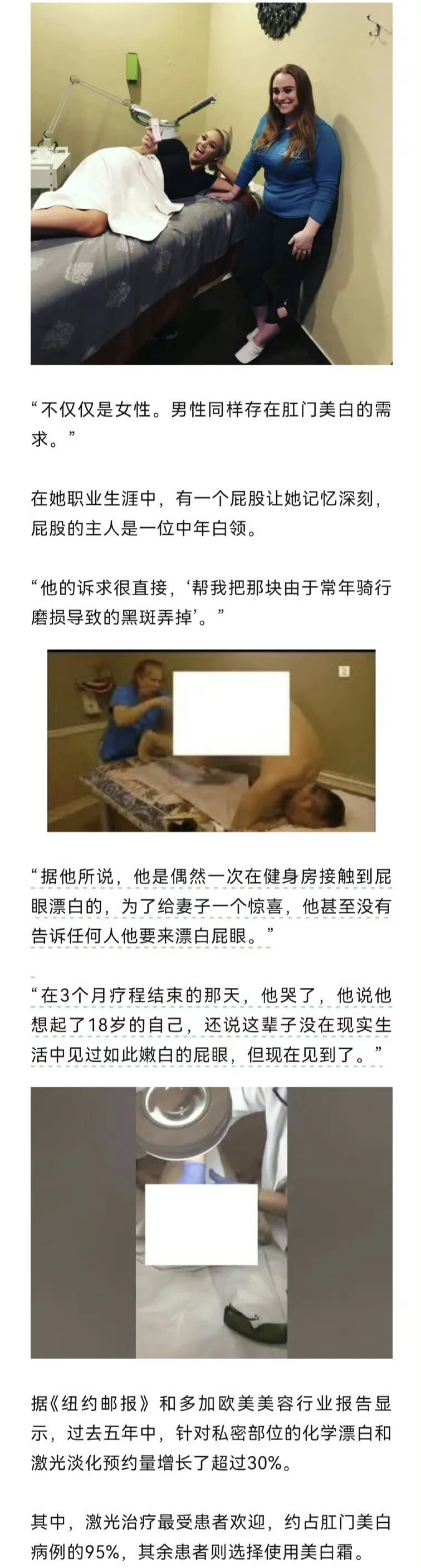 美白,皮燕,欧美,上流社会,时髦,美容,漂白,草莓奶昔,激光,ass